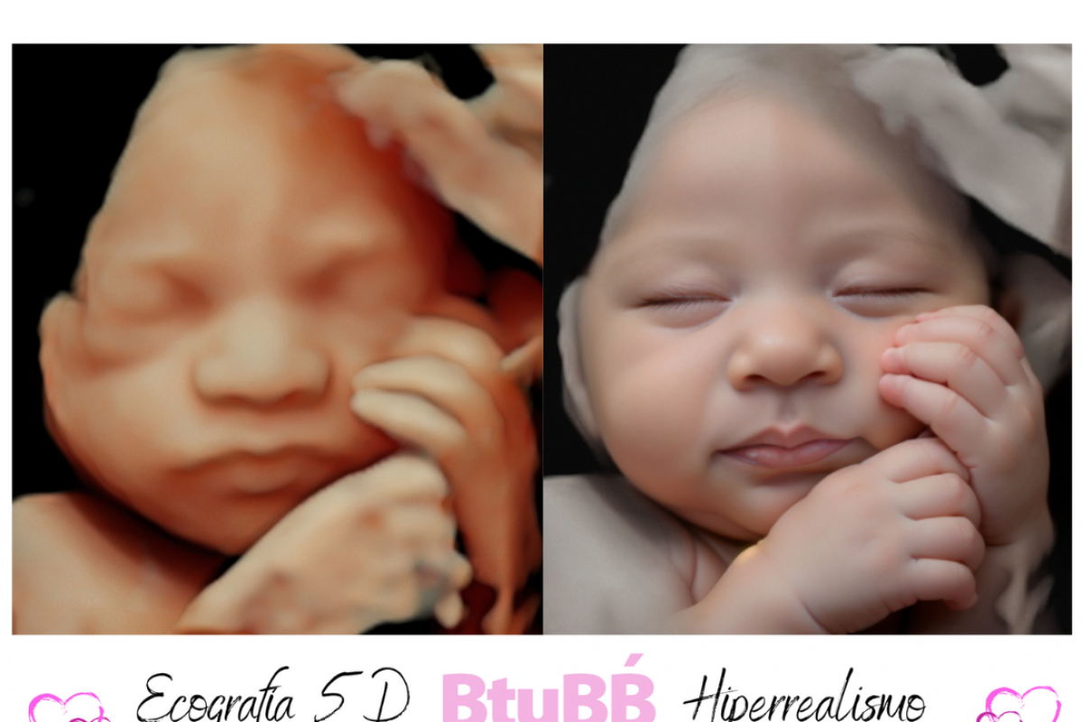 Mujer embarazada tomando ecografía 5d en Cartagena por BtuBB.es