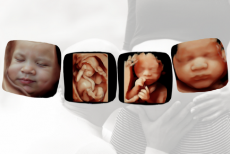 BtuBB ecografía 5d pack mini